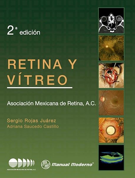 Retina y vítreo