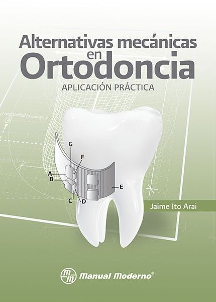 Alternativas mecánicas en ortodoncia.